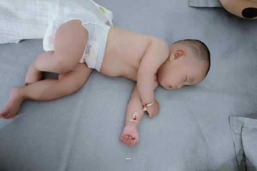 秦皇岛宝宝脸上有白色斑块